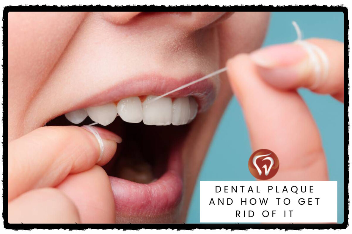 Dental Plaque And How To Get Rid Of It