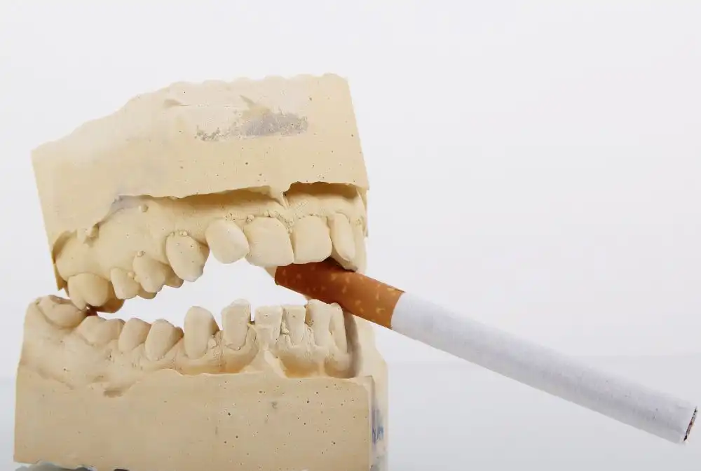 How Smoking Affects Your Teeth and Gums